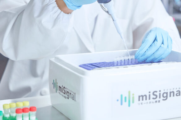自宅で簡単マイクロRNAでがんリスク検査｜マイシグナル®